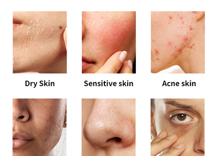 6-in-1 Multifunctional Phototherapy Beauty Device, LED Facial Beauty Device, Portable, Moisture Detection, SkinDr600, CE, RoHS, FCC Listed